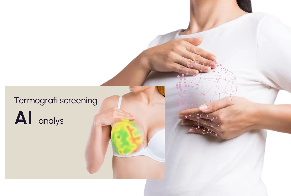 Thermalytix bröstscreening: värmekarta med AI-analys